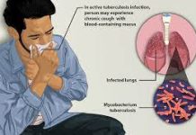 TB burden very high among vulnerable Nigerians, NGO reveals
